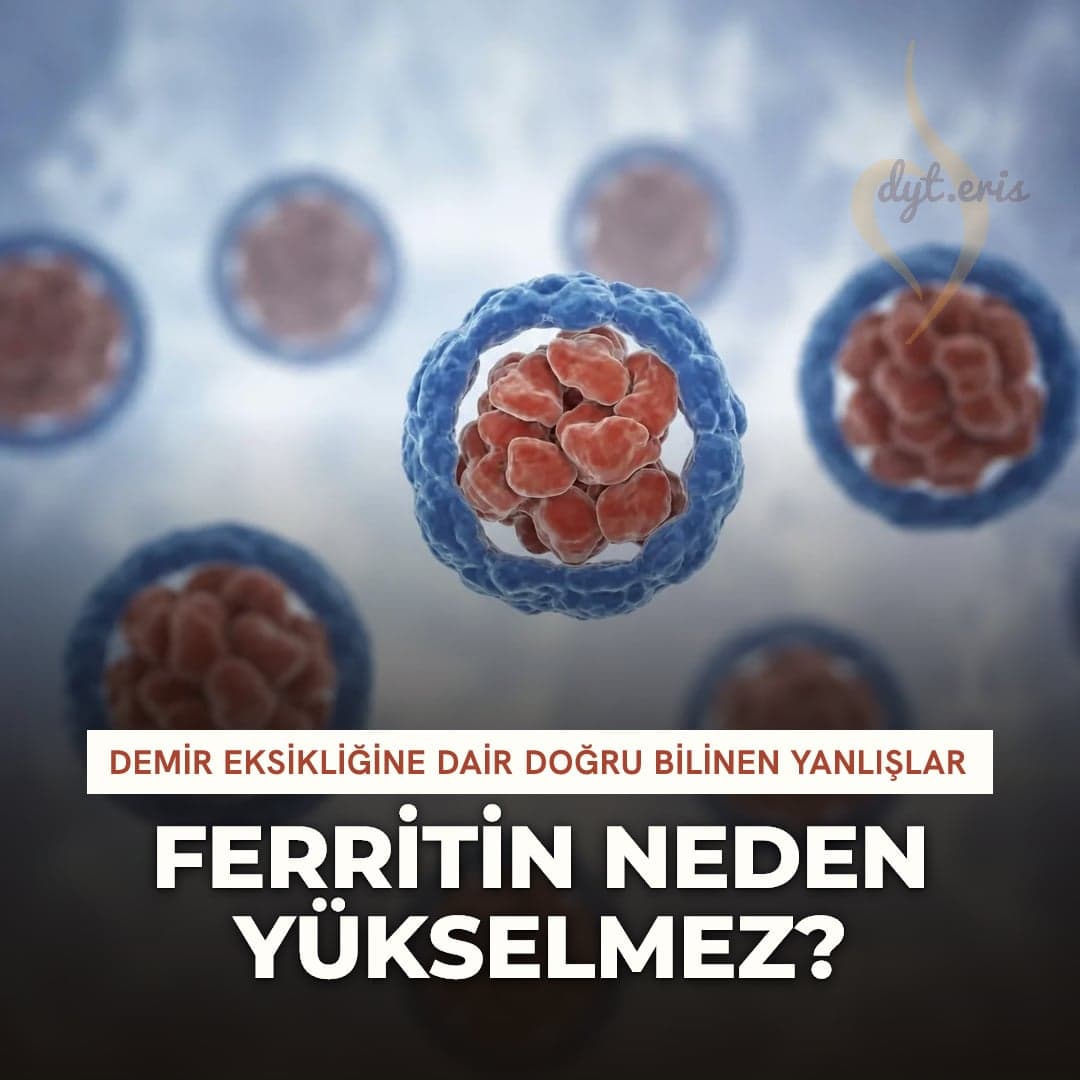Ferritin ve demir eksikliği: doğru bilinen yanlışlar
