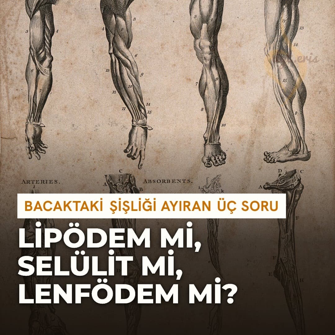 Kol ve bacağın kas, damar ve lenf yapısını gösteren tarihi anatomi levhası
