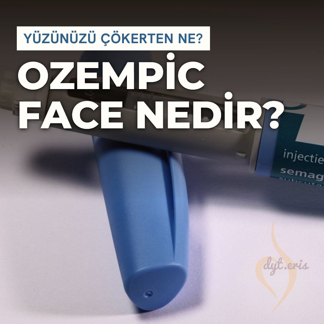 Mavi bir zayıflama iğnesi kalemi, üzerinde 'Yüzünüzü çökerten ne? Ozempic Face Nedir?' başlığı