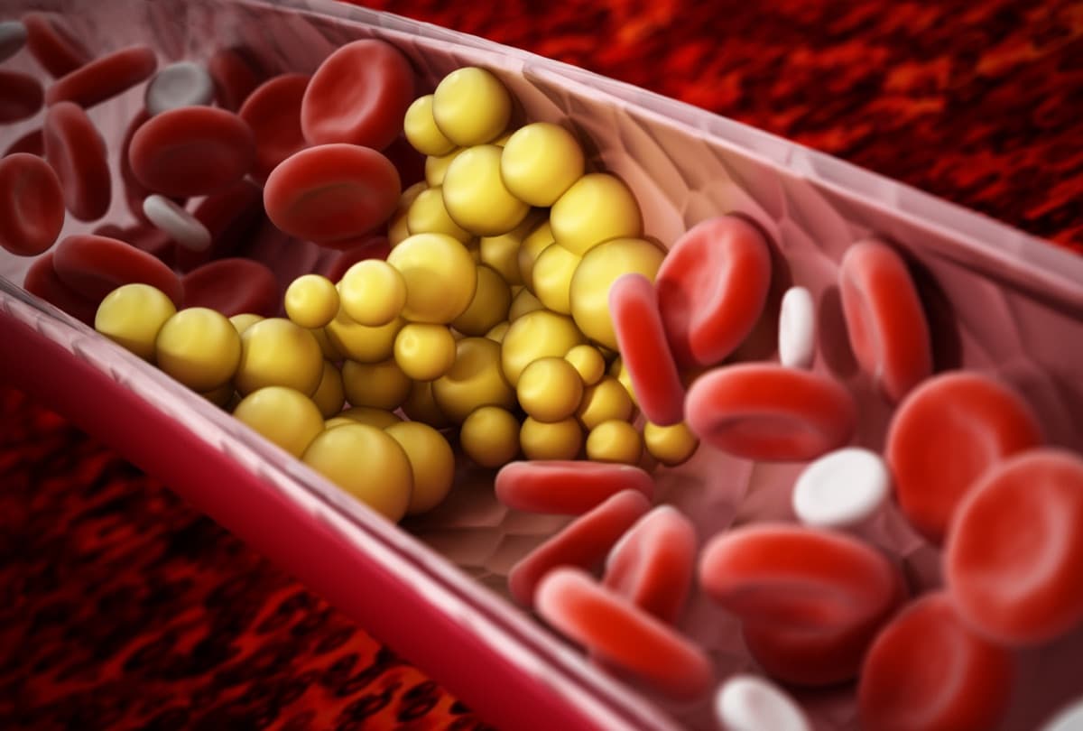 Damar içinde kırmızı kan hücreleri ve kolesterol birikimi — metabolik sağlık yönetimi