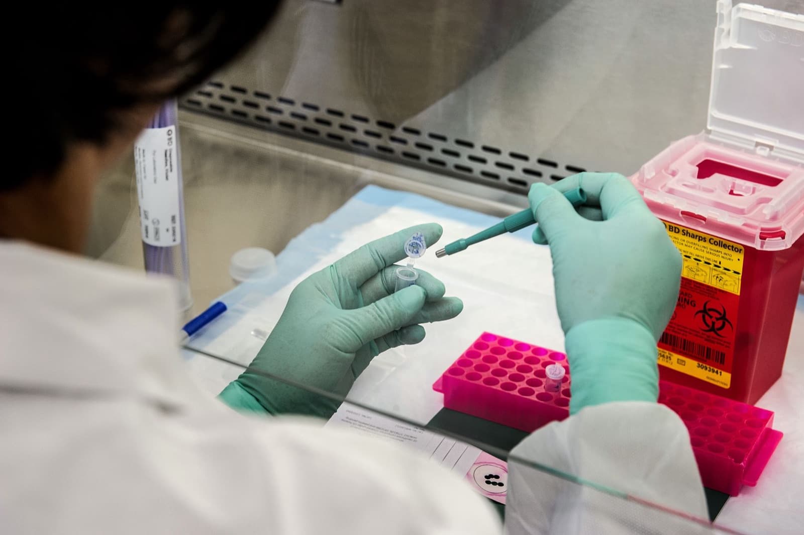 Eldivenli ellerin pipetle mikroplakaya örnek aktarması